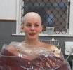 Making prosthetics